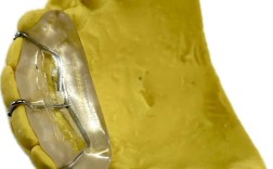 正畸平面导板的矫正原理是什么？