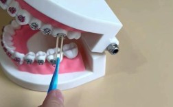 正畸橡皮链怎么用？正确使用方法与步骤解析