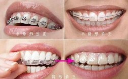 正畸治疗该选国外还是国内？效果、费用、技术差异全面解析，如何根据自身需求做最优决策？