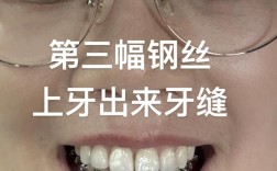 正畸牙齿能上下移动吗？方向控制有难度吗？