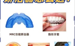 牙齿地包天矫正疼吗？治疗过程会有多痛苦？