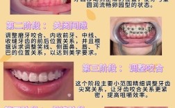 正畸如何将上牙前推