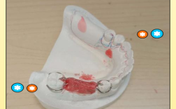 口腔正畸卡环弯制视频教学中，如何快速掌握不同类型卡环的弯制要领与临床应用技巧？