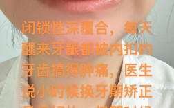 22岁矫正牙齿，这些危害真的存在吗？