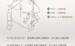正畸SN MP角度