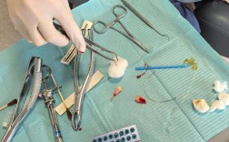 矫正牙齿为什么要拔4颗？