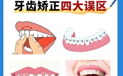 矫正牙齿能只矫一排吗