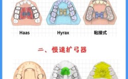 正畸控根辅弓王八曲