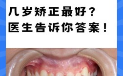 地包天矫正的最佳年龄是几岁？越早越好吗？