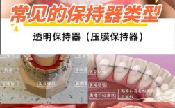 牙齿矫正器有哪几种？不同类型怎么选？