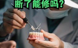 牙齿断了之后，种牙是必须的治疗方案吗？