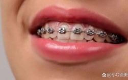 正畸大牙绞钢丝的主要作用是什么？