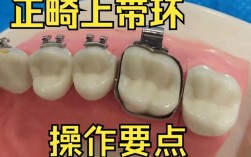 正畸带环怎么粘？粘贴步骤及注意事项详解