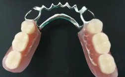 牙齿搭桥的方法好不好