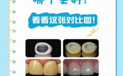 种牙和全瓷牙哪种更好？优缺点与适用人群怎么选？