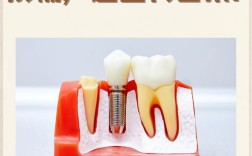 种牙假牙掉了怎么办？正确处理方法详解