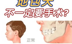 地包天该选正畸还是修复？哪种矫正方案更有效？