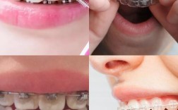 成都成华区矫正牙齿，哪家医院靠谱？价格和效果如何？