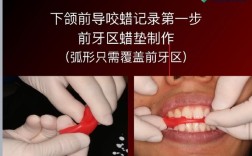 牙科蜡片制作方法全解析，从材料选择到塑形技巧，关键步骤和常见问题如何把控？