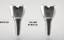 2025年国产进口种植牙区别在哪？性价比怎么选？
