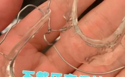 牙齿长期不矫正，会对咀嚼、美观和健康有哪些影响？