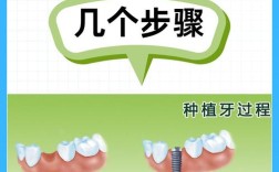 种植牙从手术到完全恢复需要多长时间？