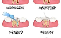 口腔下颌7开髓方法的标准操作流程及操作技巧有哪些？