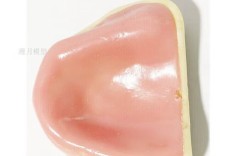 种牙时上额窦被刺破，能顺利长好吗？