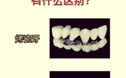 烤瓷牙种牙危害