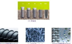 韩国vs瑞士种牙，哪种更适合？关键差异在哪？