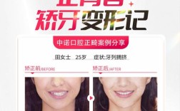 正畸治疗如何通过牙齿排列改善面部美学？其与微笑设计的关联又该如何精准把握？