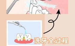 超声波洁牙的方法步骤