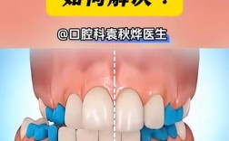 正畸中线不齐怎么办