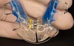 正畸艺术曲弯制