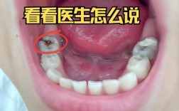 正畸牙齿连着神经