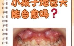 儿童治疗反合有几种方法