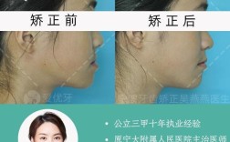 安氏一类正畸真的没用？治疗效果遭质疑？