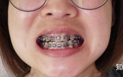 北大口腔正畸脸