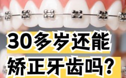 三十岁矫正牙齿还来得及吗？