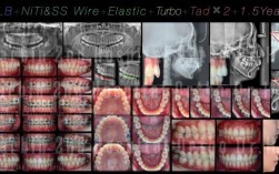 2025正畸病例比赛将聚焦哪些创新技术？