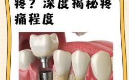 种牙真不疼吗
