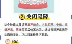何为正畸替牙间隙？名词解释的核心内容是什么？