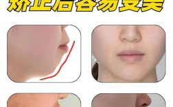 矫正牙齿会导致脸变长吗？