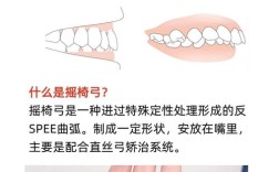 正畸扶8装置要准备哪些