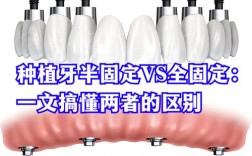 种牙和自己的牙在功能、寿命等方面有何区别？