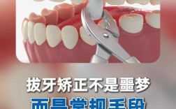 正畸拔牙一般拔哪些牙