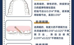 正畸换几种弓丝