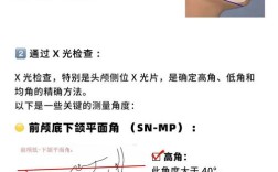 正畸牙高位低位定义