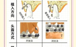 下颌种植支抗方法的适用情况与效果怎样？