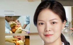 无锡爱牙门诊种牙怎么样？种植效果、医生技术、口碑评价如何？